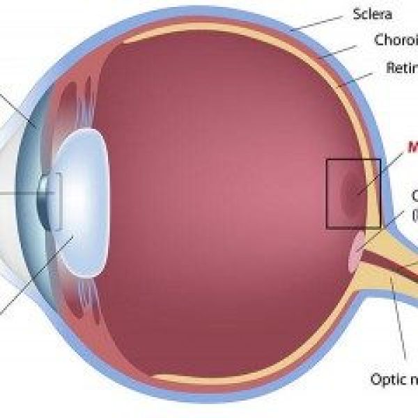 eye disease macular degeneration