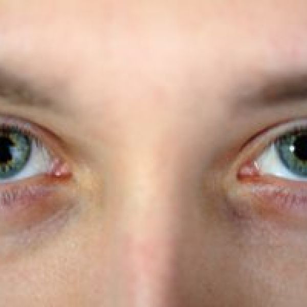 healthy eyes